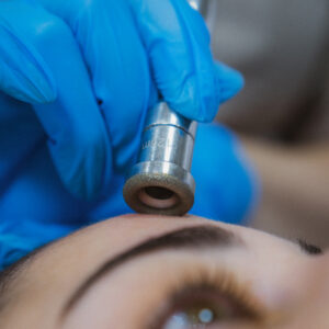 Microneedling con Skinpen + EXOSOMI (cellule staminali vegetali) Viso + Collo + Decolleté