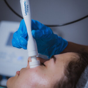 Biostimolazione senz'aghi - Biodermogenesi Viso-Collo-Deco Biotermogenesi