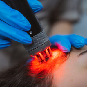 Terapia Antiage Rigenerativa TRICOPAT APS